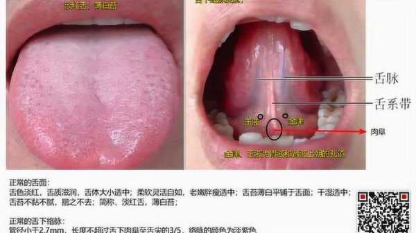 舌腹是舌头哪个位置（舌腹部正常图片）-图2